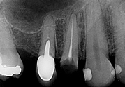 OrtoDent - dentalni radiogrami